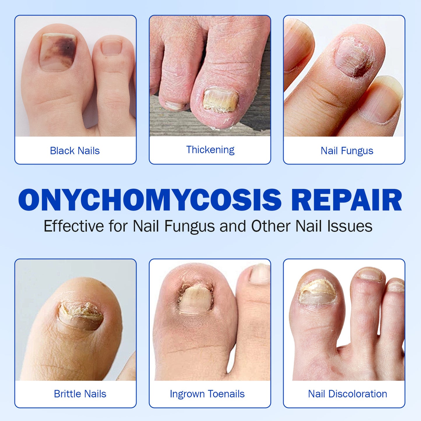 Antibacterial Nail Patch