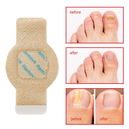 Antibacterial Nail Patch