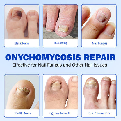 Antibacterial Nail Patch